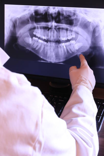 Best Emergency Dental Care for Broken or Chipped Teeth in Pennside, PA
